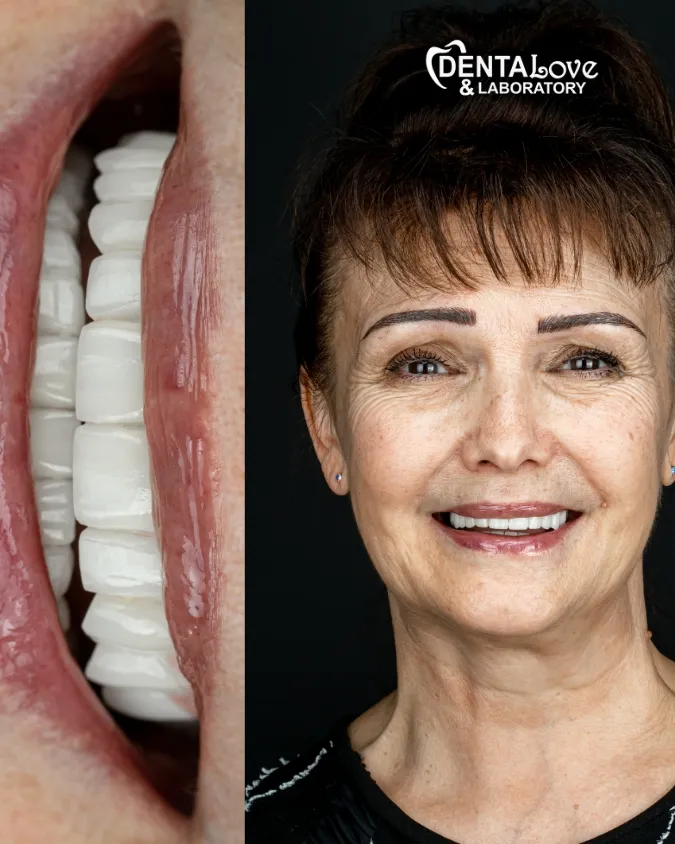 31 Paziente Dentalove