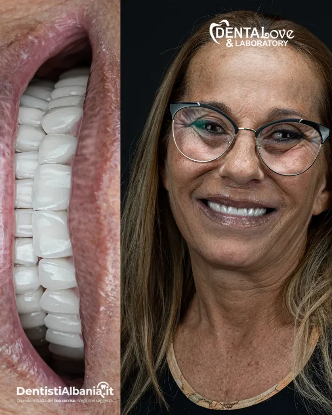 33 Paziente Dentalove