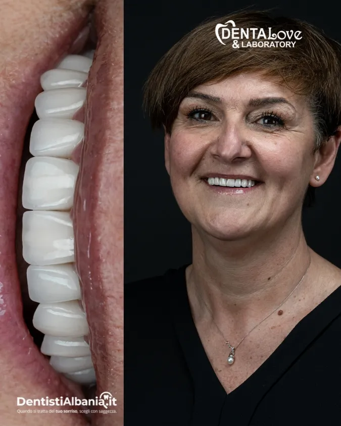 34 Paziente Dentalove