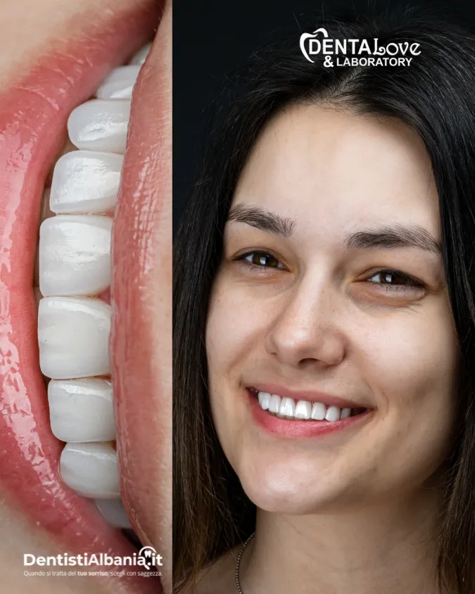 35 Paziente Dentalove