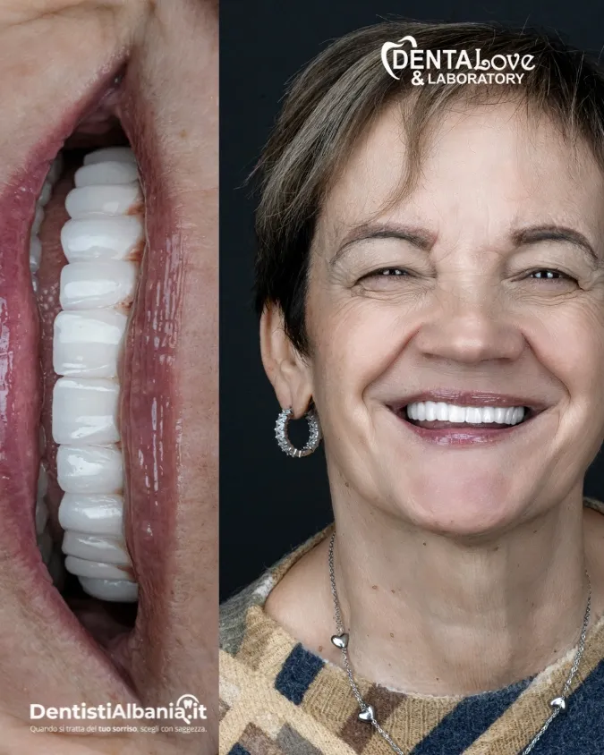 37 Paziente Dentalove