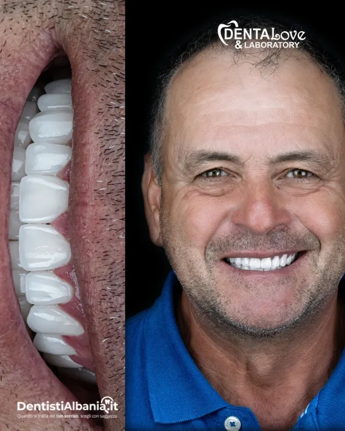 38 Paziente Dentalove