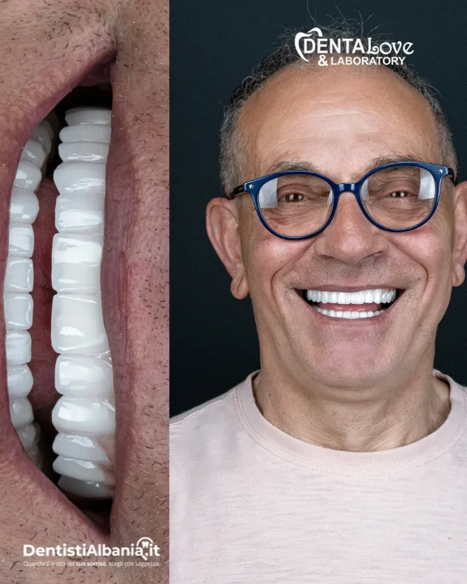 39 Paziente Dentalove