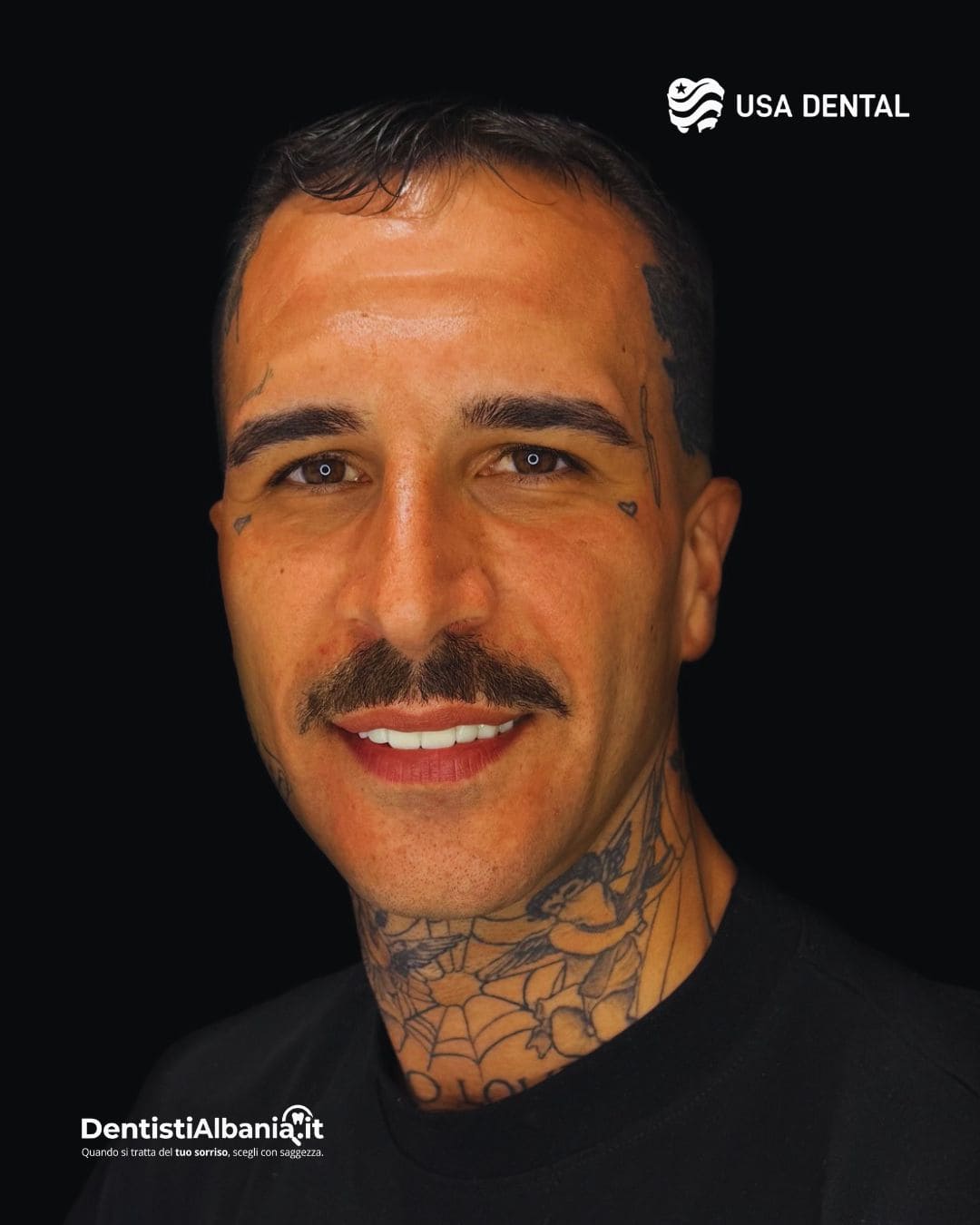 43 Paziente Biodent Dental Clinic