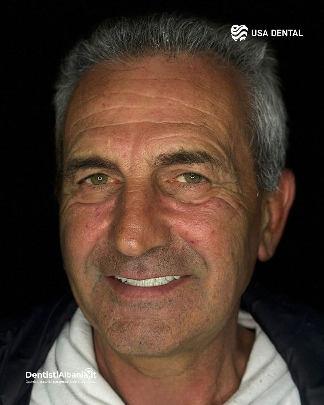 48 Paziente Biodent Dental Clinic