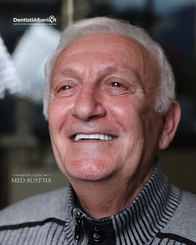 Turismo Dentale con Dental Med Austria. Paziente Soddisfatto