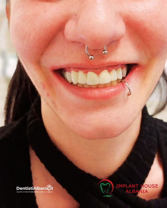 Dentisti Albania foto gallery Paziente Biodent Dental Clinic